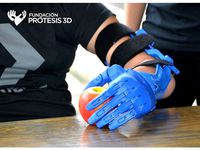 Unlimbited FP3D by FundacionProtesis3D