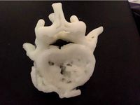 dorsal vertebrae fracture by andrepenha
