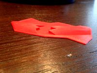 open arm fracture by Aep