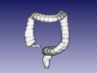 large colon by orthotobi