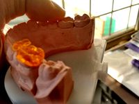 Upper Jaw and copying model fittings by alebarboza