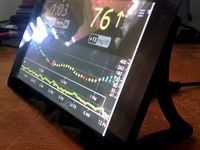 Raspberry Pi 7” Touchscreen Display Legs by LarsonLR