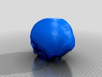 skull ct  by cons_ng_