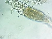 phone microscope adapter by 3DAmsterdam