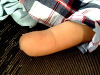 Kaic 1 year - new arm with entry by Tectrixinfo