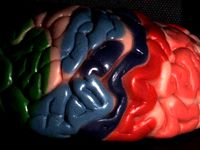 Scan from model of human brain by HGW