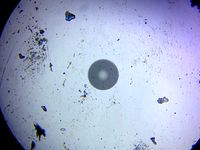 iPhone Fiber Optic Microscope adapter by dfarrar117