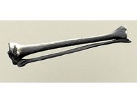 Human Tibia and Fibula by sjpiper145