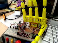 Multiplexed Prosthetic Devices by sandrabaskharon