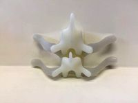 Thorax vertebra holder by ealdomar