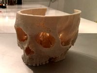 Live CT data: My wifes skull reconstructed by udomuc
