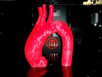 Thoracic Aorta by l8aarx