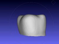 Tooth Crown by spicygeorge