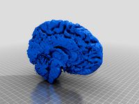 Living brain, Left part. by Neurohack