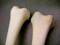 Right Femur by BME_Sundevil