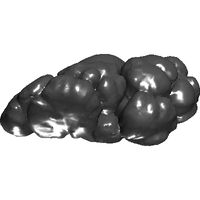 3dpx-00335720hydronephorsis20nevitdilmen.prj