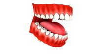 Mouth Teeth Set Adult