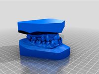 My class III Malocclusion (underbite) by makersoup
