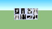 x ray screen